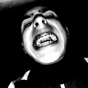 Бешеный пёс