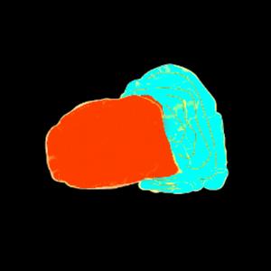 The Skin Tone Of Wolfe Tone