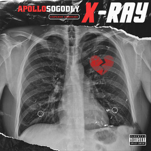 X-ray (Explicit)