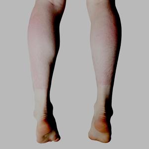 sunburn (Explicit)