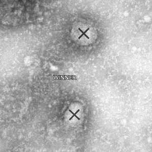 Winner