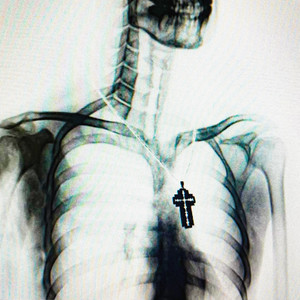 РЕНТГЕН (Explicit)