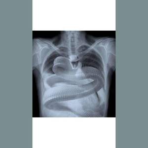 病 Prod by Young oz