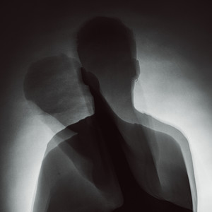 Misplaced (Explicit)