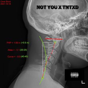 Not You(feat. TNTXD) (Explicit)