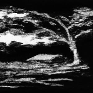 sarko****it (feat. Setä-Anarkia) (Explicit)