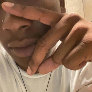 2MUCH2HANDLE (Explicit)