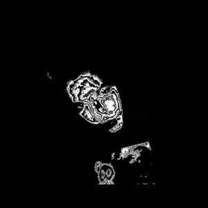 red dot freestyle #visionscore (Explicit)