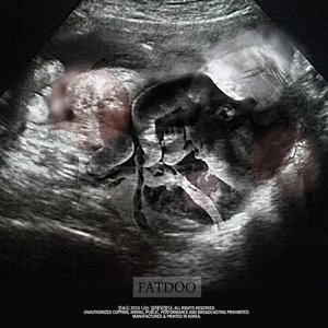 나는 잉태되었다 (我怀孕了)