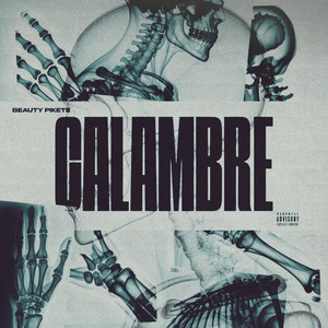 Calambre