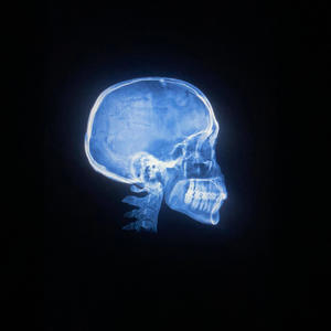 Memory Loss! (Explicit)