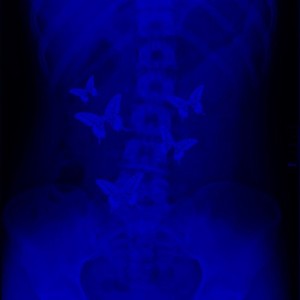 Farfalle nello stomaco