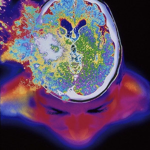 A LOT ON MY MIND (Explicit)