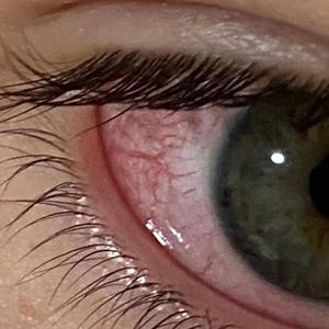 KITTYSCRAPE (Explicit)