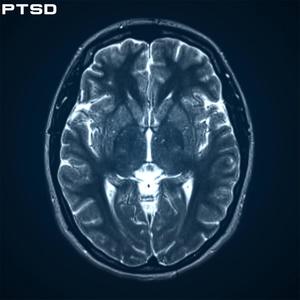 PTSD