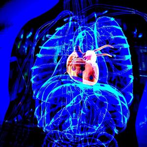heart attack (Explicit)