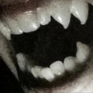 20 ***** (Explicit)
