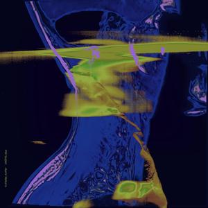 Siah (HyperMyst Remix)