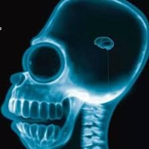 BRAINLESS (feat. MCNP) (Explicit)