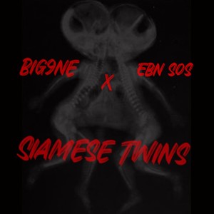 Siamese Twins (Explicit)