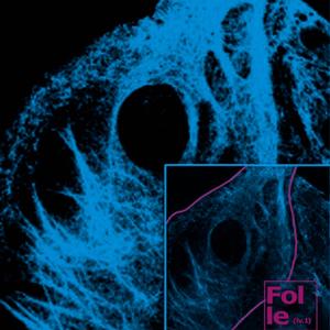 Folle (lv.1) (feat. pollokraken) (Explicit)