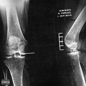 Torn Acl (Explicit)