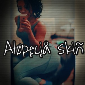 Alopecia Skin (Explicit)