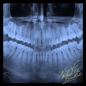 Beat Blocks (Explicit)