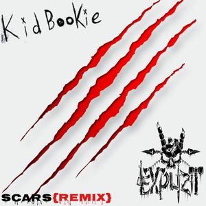 Scars (feat. Kid Bookie) [Remix]