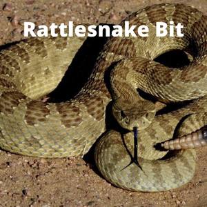 Rattlesnake Bit