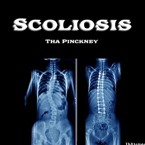 SCOLIOSIS (Explicit)