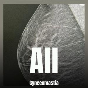 All Gynecomastia