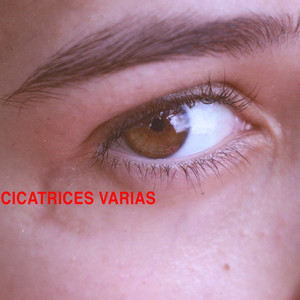 Cicatrices Varias