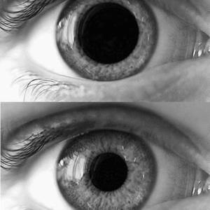 Withdrawals (Explicit)