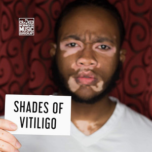 Shades of Vitiligo (Explicit)