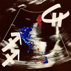 SKYLINE CRUMBLES (feat. Mister JT)