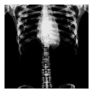 GRAVEYARD (Explicit)