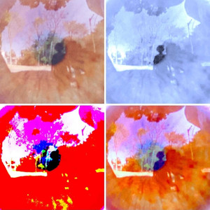 Da Retina Ao Coração