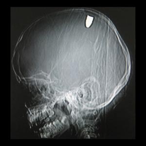 PUT A BULLET IN MY BRAIN. (Explicit)