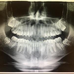 F.Y.F. (feat. Con-Way & Réz) (Explicit)