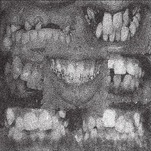 ****FRATT (Explicit)