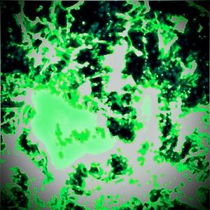 Toxic