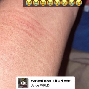 Not A Cry For Help(NACFP)