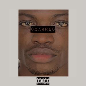 Scarred (Explicit)