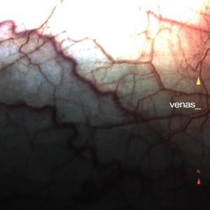 venas_