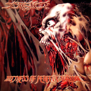 Ripping the Pregnant