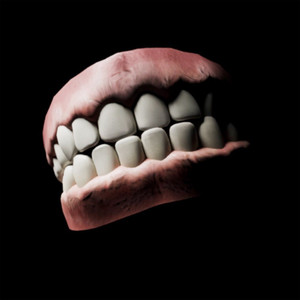 veneers. (Explicit)
