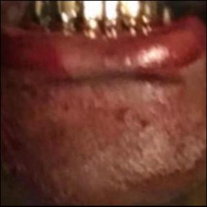 WATCHEMBLEED (Explicit)