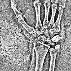 bones (feat. heylog)