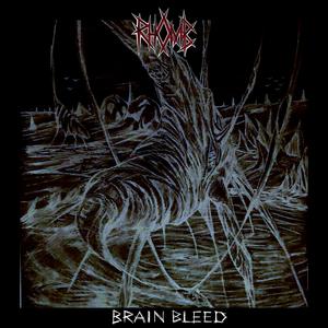 Brain Bleed